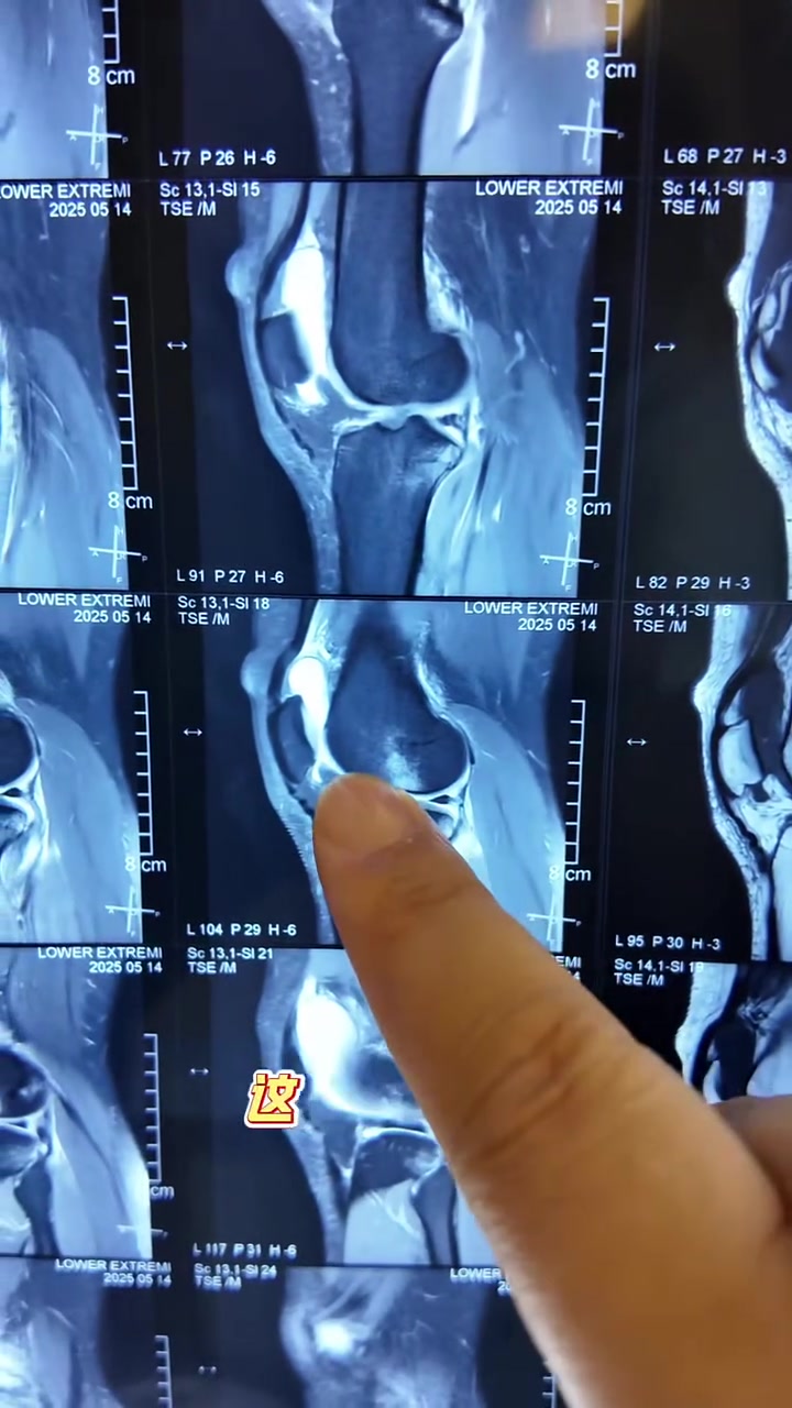 麦迪逊韧带受伤短期缺阵引球队战术担忧的简单介绍  第2张